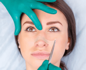 Какво трябва да се вземе предвид преди и след ринопластика